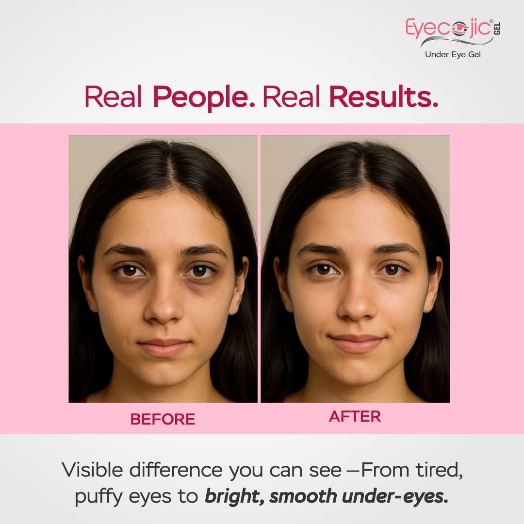 Eyecojic Under Eye Gel for Reducing Dark Circles With 2% Kojic Acid - Image 5