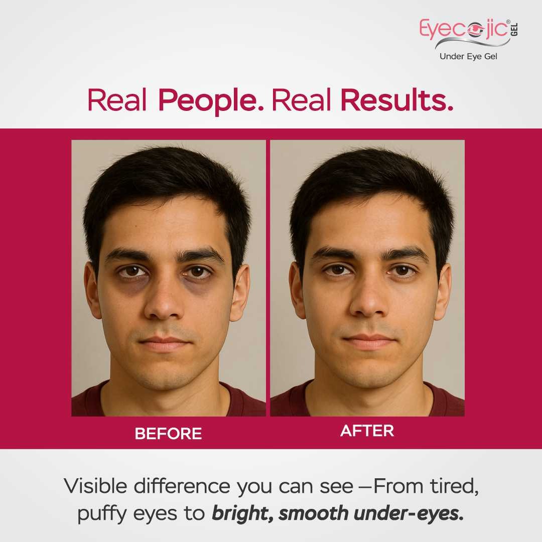 Eyecojic Under Eye Gel for Reducing Dark Circles With 2% Kojic Acid - Image 6